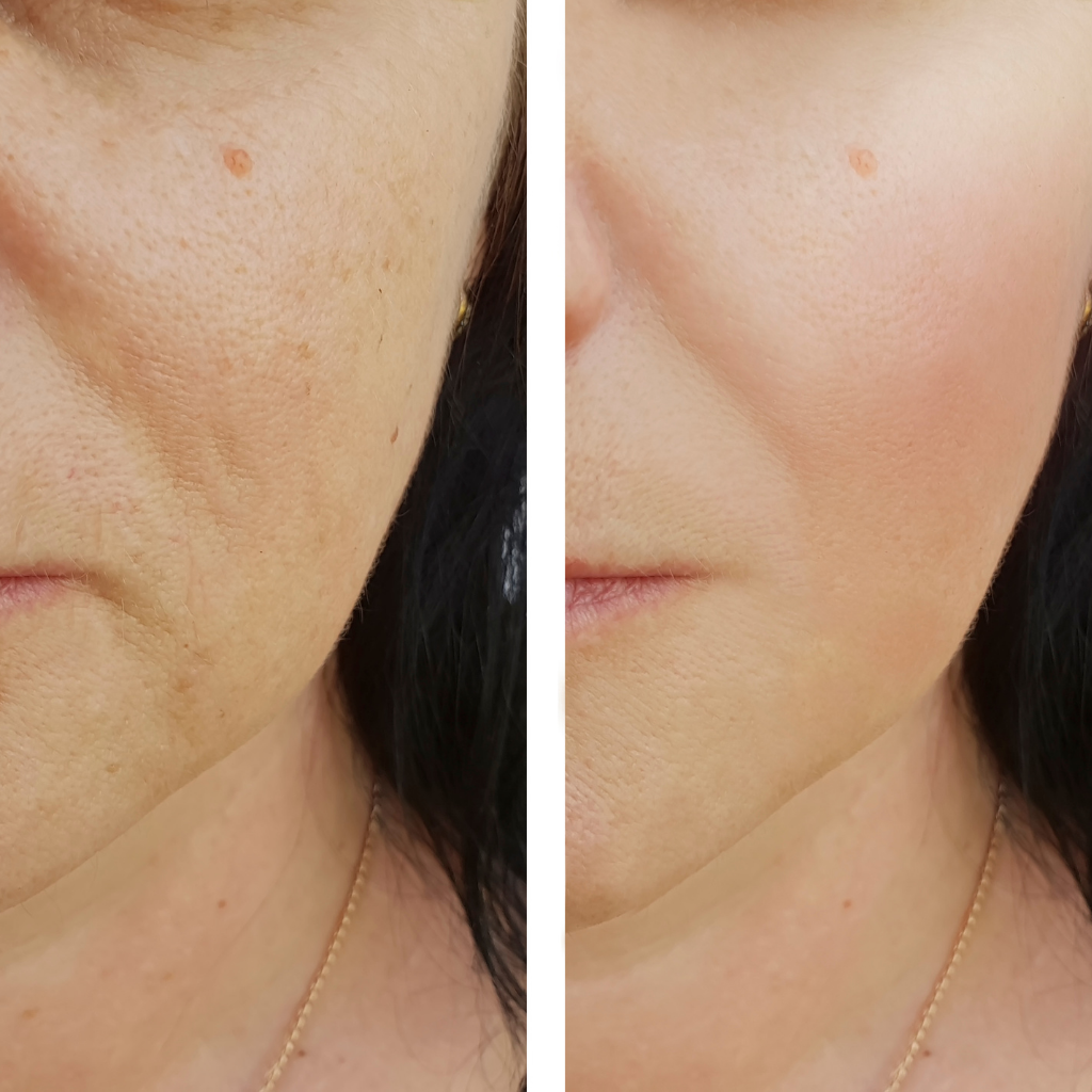 top 5 krivih uvjerenja o kolagenu